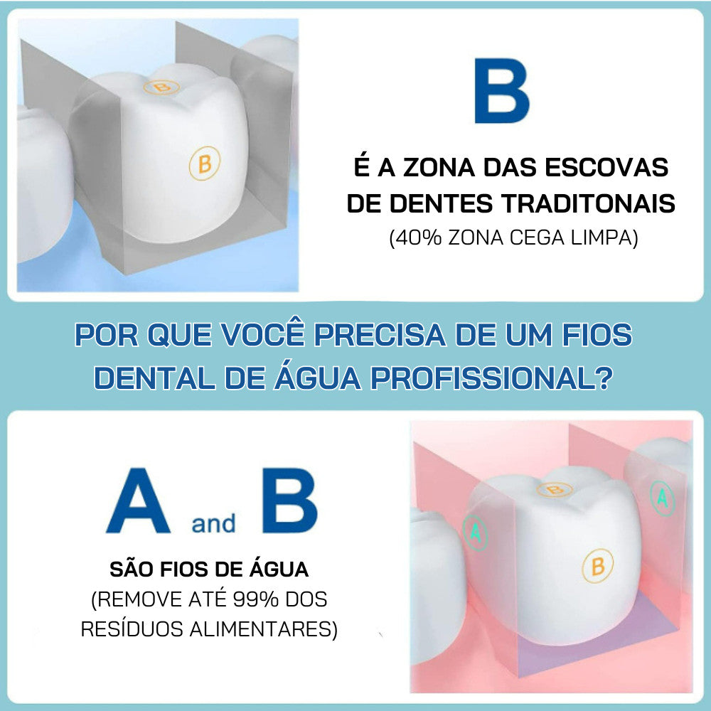 Irrigador Oral Jato de Água Dental Water Flosser Bucal Recarregável Portátil Sem Fio